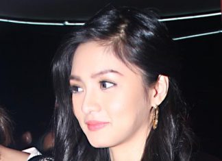 Kim Chiu, maayos na ang naaksidenteng ilong