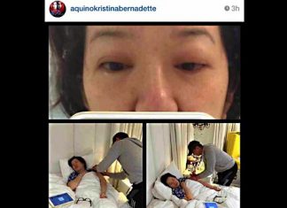 Kris Aquino, ininom ang gamot ni Joshua Aquino, nagkaroon ng matinding allergy