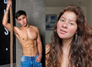 HINDI NAKATANGGAP NG SORRY: Albie Casiño hindi na pagtatakpan si Andi Eigenmann